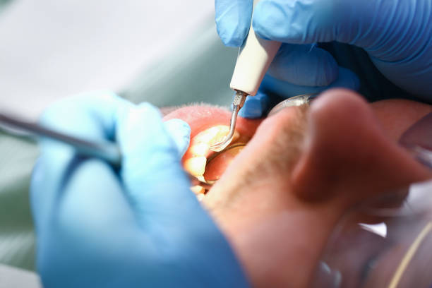 Best Emergency Gum Pain Relief  in Port Arthur, TX